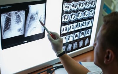 El impacto de la pandemia de COVID en el cáncer: Sanidad prevé más casos de pulmón, mama y colon